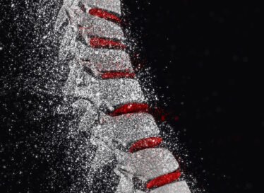 3D render of a spine with disintegration effect